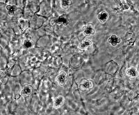 Coprinopsis neophlyctidospora UAMH 11404 basidiospores