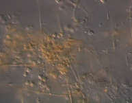 OATC · 22d · 25C · DIC