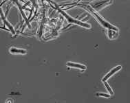 PDAC · 15d · 25C · PH