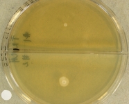 14d · 35C