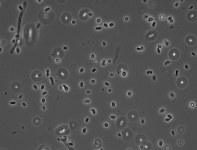 PDAC · 30C · PH