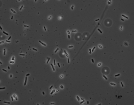 PDAC · 18d · 30C · PH