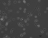 PDAC · 18d · 30C