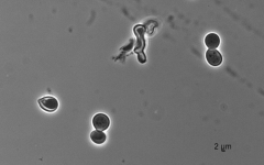 15d · 35C