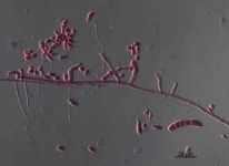 sc · 14d · 30C