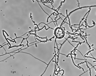 sc · 13d · 30C · PH