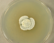 PDAC · 36d · 9C