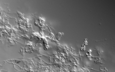 CER · 15d · 30C · DIC