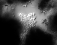 PDA · 44d · RT · DIC