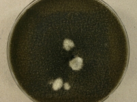PDAC · 14d · 22C