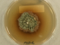 PDAC · 34d · 22C