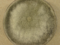 PDAC · 14d · 22C