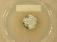 PDAC · 28d · 22C