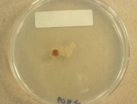 PDAC · 30d · 18C