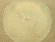 PDAC · 29d · 22C