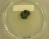 PDAC · 34d · 25C