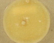 PDAC · 35d · 22C