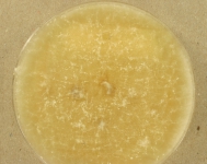 PDAC · 35d · 22C