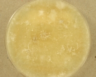 PDAC · 35d · 22C