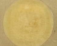 PDAC · 35d · 22C