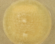 PDAC · 35d · 22C