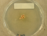 PDAC · 21d · 30C