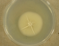 PDAC · 13d · 18C