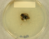 PDAC · 34d · 18C