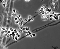 Myceliophthora thermophila UAMH 11479