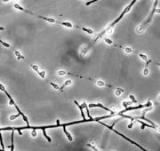 UAMH 9024 Onychocola kanei microscopic