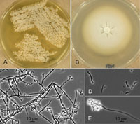 UAMH 11532 Phialosimplex caninus