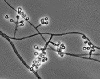 Geomyces species UAMH 11161