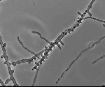 Microsporum audouinii UAMH 10507