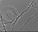 Microsporum audouinii UAMH 10507