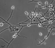 Chamaeleomyces granulomatis UAMH 11178