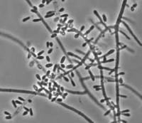 Chrysosporium anamorph of Nannizziopsis vriesii UAMH 10200