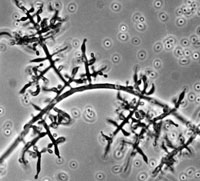 Trichoderma longibrachiatum UAMH 10147