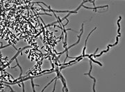 UAMH 10296 Ophidiomyces ophiodiicola