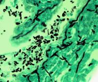 GMS stained reptile skin showing hyphae UAMH 10199