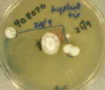 UAMH 10949 Ophidiomyces ophiodiicola growing from skin biopsy from green anaconda snake 