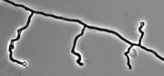 UAMH 11295 Ophidiomyces ophiodiicola undulate hyphae